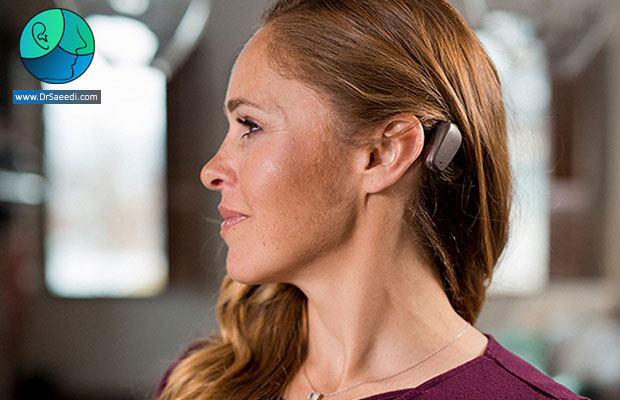 جراحی سمعک باها