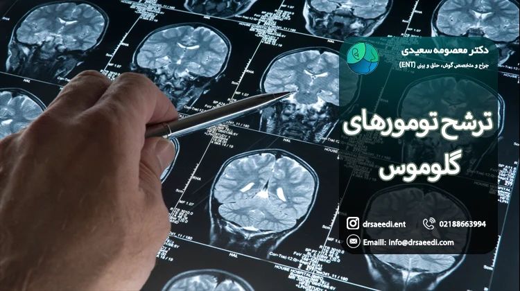 علائم تومور گلوموس
