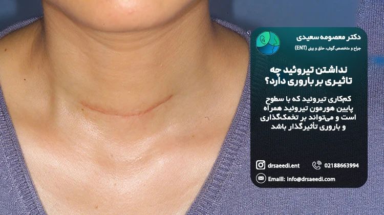 باروری پس از عمل تیروئید