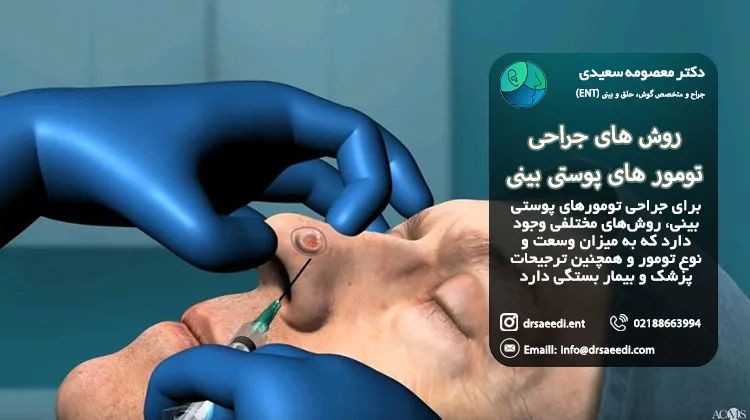 عمل سرطان پوستی بینی