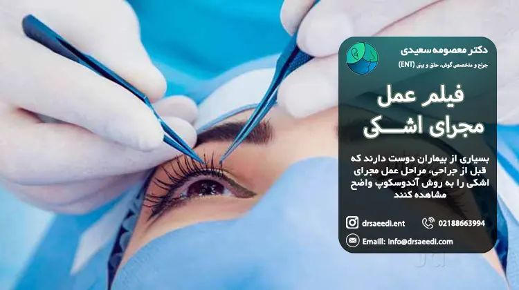 فیلم عمل مجرای اشکی