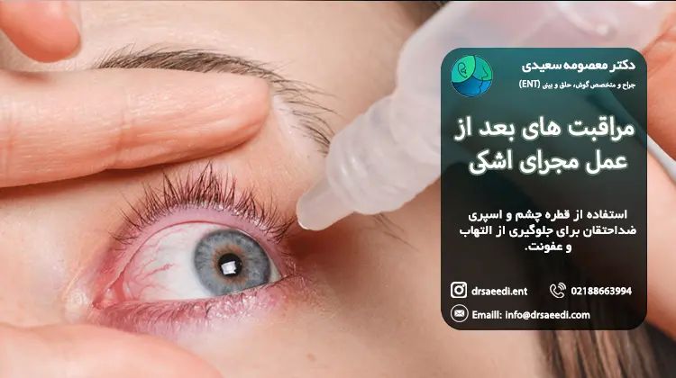 مراقبت های بعد از عمل مجرای اشکی