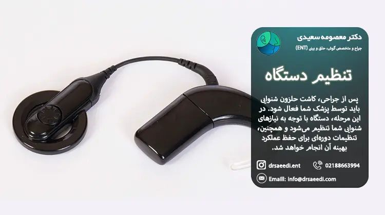 تنظیم دستگاه بعد از کاشت حلزون
