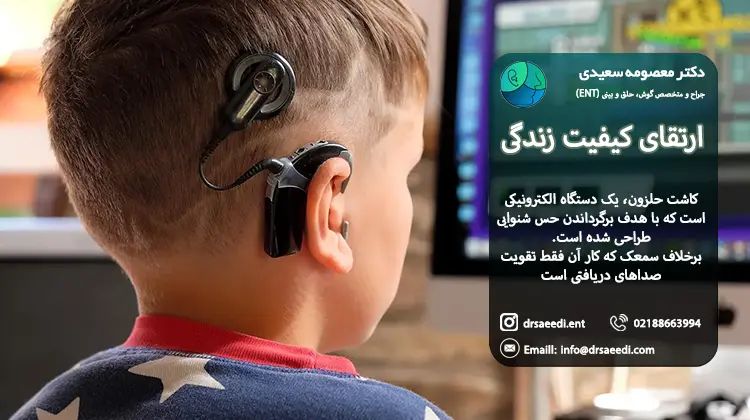 کاشت حلزون و افزایش کیفیت زندگی