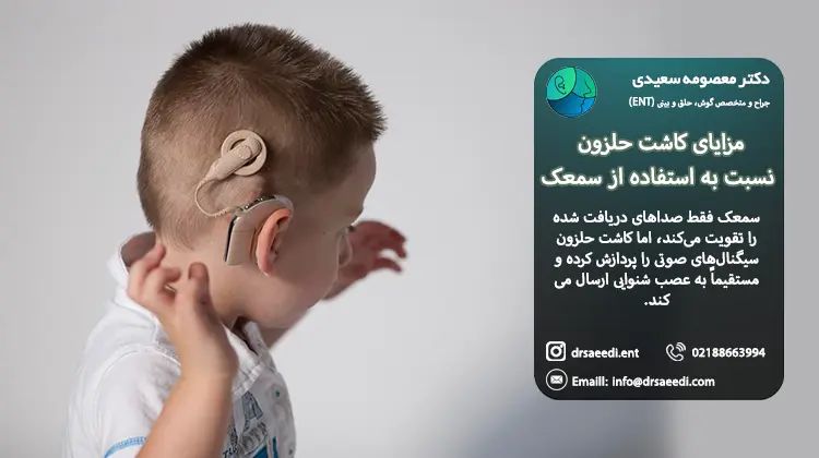 مزایای کاشت حلزون نسبت به سمعک