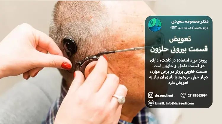 تعویض پروتز کاشت حلزون