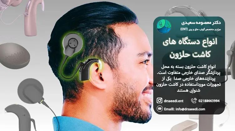 دستگاه های کاشت حلزون