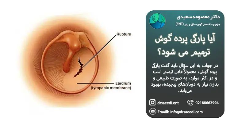 آیا پارگی پرده گوش ترمیم می شود؟