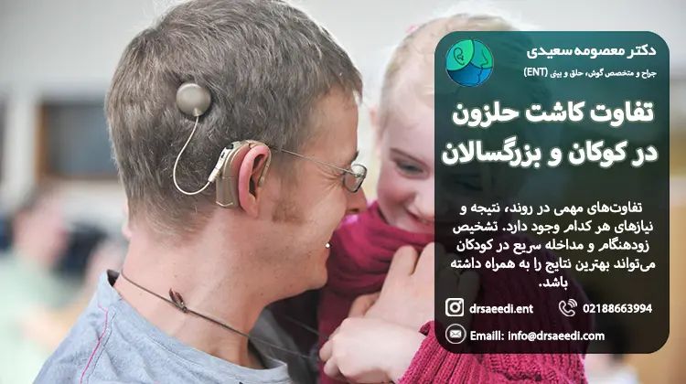 تفاوت کاشت حلزون در بزرگسالی با کودکان