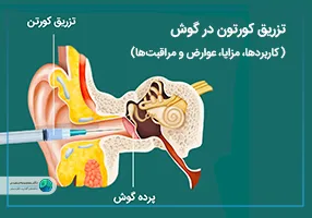 تزریق کورتون در گوش
