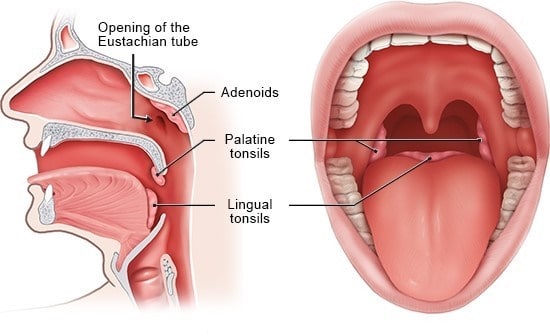 Tonsillectomy And Adenoidectomy In Iran With Dr Saeedi Ent Surgeon